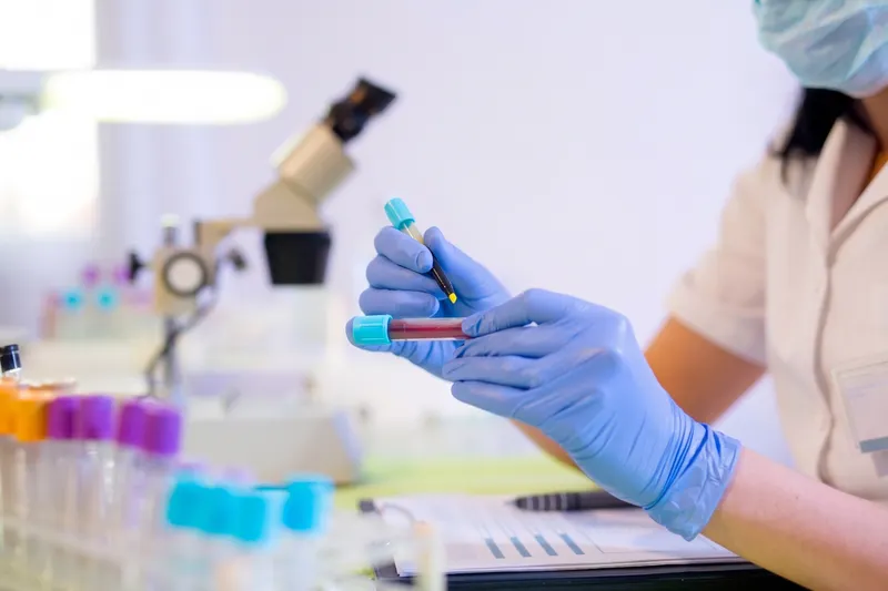 Profesional de laboratorio manipulando una muestra de sangre